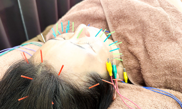 鍼灸×整体ｓａｌｏｎ　ｉの代表的な写真