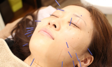 鍼灸整骨院Ｌｉｆｅの代表的な写真