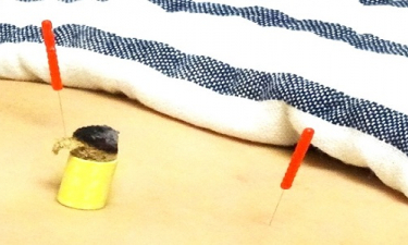 鍼灸　a　tes　cotesの代表的な写真