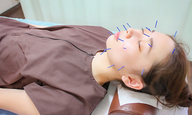 梅沢鍼灸院の代表的な写真