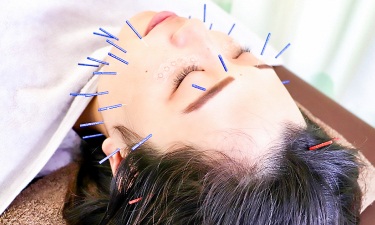 かわうち鍼灸接骨院　新発田院の代表的な写真