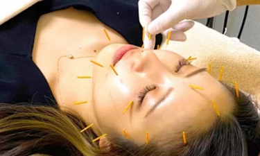 はり・灸・マッサージ 東京荻窪ＫＡＺ治療院【鍼灸】の代表的な写真