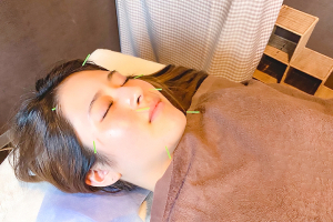 ピュア整骨院・鍼灸院　末広町院の美容鍼施術の施術風景画像です。