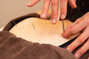 アム鍼灸マッサージ院　有楽町の鍼灸施術の施術風景画像です。