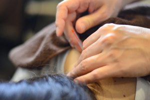 あかさか二丁目接骨院の鍼灸施術の施術風景画像です。