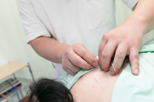 梅沢鍼灸院の肩こりの施術風景画像です。