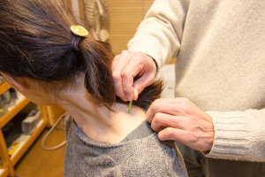 東洋治療センター滝鍼灸院の鍼灸施術の施術風景画像です。