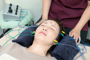 五健鍼灸整骨院　経堂本院の美容鍼施術の画像