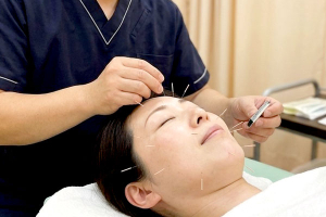 健康堂接骨鍼灸マッサージ院の美容鍼の施術風景画像です。