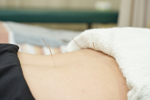 鶴間あおば接骨院はりきゅう院の鍼灸の施術風景画像です。