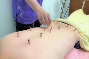 田子浦鍼灸接骨院の腰痛の施術画像