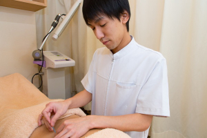 もりわき鍼灸整骨院 上新庄院の鍼灸施術の画像