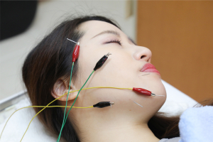 いずみ鍼灸院の美容鍼の画像