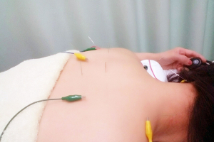 なる鍼灸治療院の鍼灸院の施術風景画像です