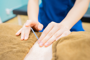 蒲生東口整骨院の鍼灸施術の施術風景画像です。