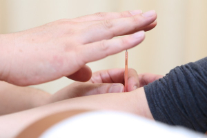 きざき鍼灸整骨院の鍼灸施術の画像