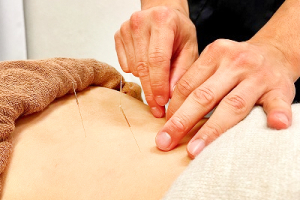 緑橋うららか鍼灸整骨院・整体院の鍼灸施術の画像