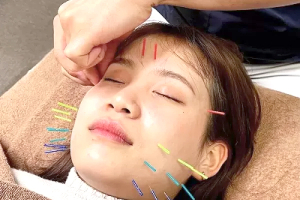 緑橋うららか鍼灸整骨院・整体院の美容鍼施術の画像