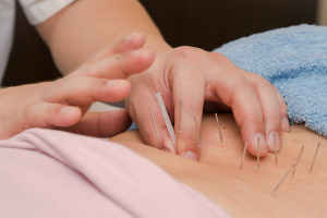 もり鍼灸院の腰痛の施術風景画像です