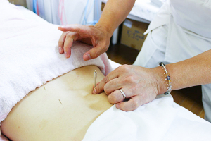 とみひさ鍼灸整骨院の鍼灸施術の画像