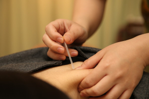 はり きゅう リラクゼーション 治療院 治haruの鍼灸施術の画像