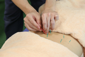 リセット整骨院　ひょうたんやま南院の鍼灸施術の画像