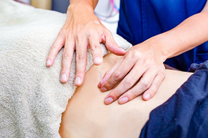 このは整骨院　倉敷市院の鍼灸施術の画像