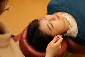 もりわき鍼灸整骨院 吹田本院の美容鍼施術の画像