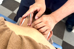 むげん整骨院・鍼灸院 大津膳所の鍼灸施術の施術風景画像です。