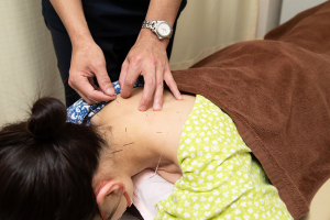 太陽鍼灸整骨院　池上院の肩こりの施術画像