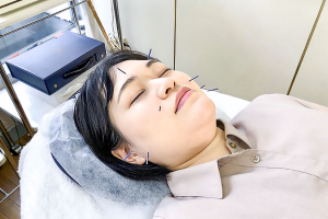 みち鍼灸治療院の美容鍼施術の施術風景画像です。