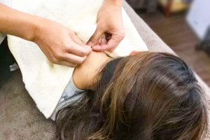 きざわ鍼灸接骨院の鍼灸施術の画像