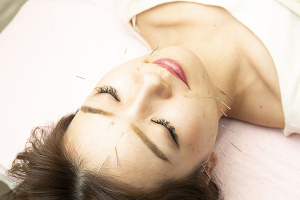 なかのう鍼灸接骨院の鍼灸施術の画像