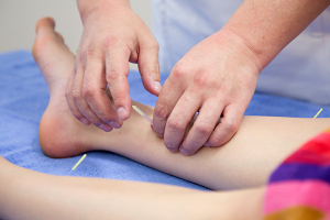 あんま・指圧・マッサージ　はり・きゅう　治療院　大石の鍼灸施術の画像