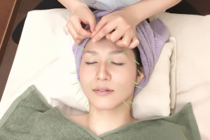 大江戸鍼灸整骨院の美容鍼施術の施術風景画像です。