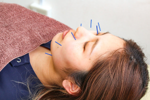 荒川鍼灸整骨院の美容鍼施術の施術風景画像です。