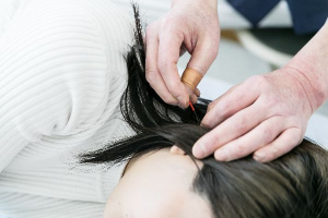 姫路 なごみ整体院・なごみ鍼灸院の鍼灸施術の画像