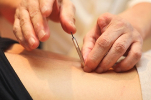 天寿堂整復院の鍼灸施術の画像