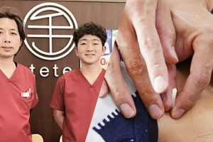 てて整骨院　館山店の鍼灸の施術風景画像です。