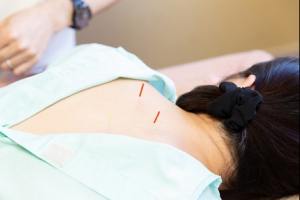 はり・温灸治療院　楽居堂の鍼灸施術の画像