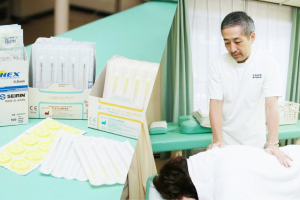 なかのや鍼灸整骨院　麻生院の鍼灸の施術風景画像