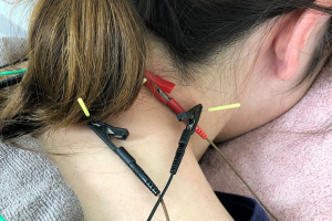 はりきゅうマッサージつかさ治療院 清水院の鍼灸施術の画像