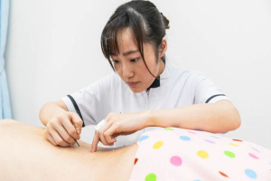 伊藤はり・マッサージサロンの鍼灸施術の画像