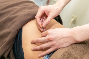 銀座鍼灸整骨院の鍼灸施術の施術風景画像です。