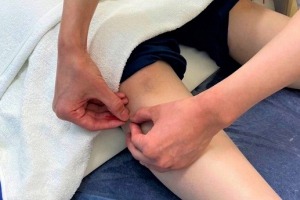 鍼灸整骨まこまないの鍼灸の施術画像