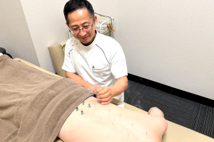 ダイアン鍼灸整骨院の鍼灸施術の施術風景画像です。