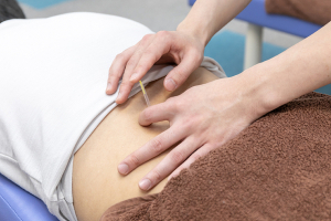 苫小牧駅はりきゅう整骨院の鍼灸施術の施術風景画像です。