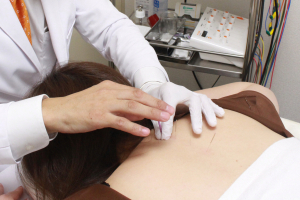 はり・灸・マッサージ 東京荻窪ＫＡＺ治療院の鍼灸施術の画像