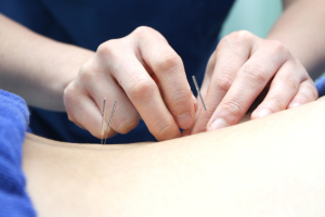 くらまえ鍼灸整骨院の鍼灸施術の施術風景画像です。