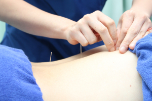 Ｆ．Ｃ．Ｃ．よみうりランド鍼灸整骨院（アメリア稲城様2階）の鍼灸施術の施術風景画像です。